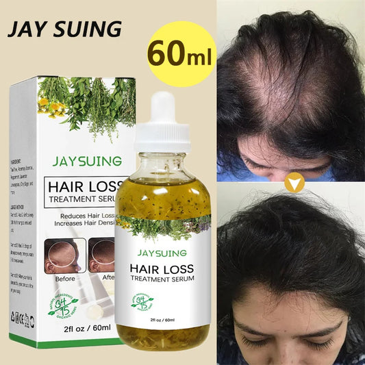 Effective Hair Growth Serum Prevent Bald Treatment Products Fast Regrowth Anti Hair Loss Nourishing Damaged Beatuy Hair Care