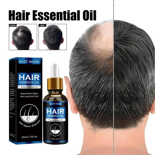 Hair Growth Oil Rapid Effective Repair Baldness Hair Follicles Hereditary Hair Loss Postpartum Hair Loss Seborrheic Hair Care