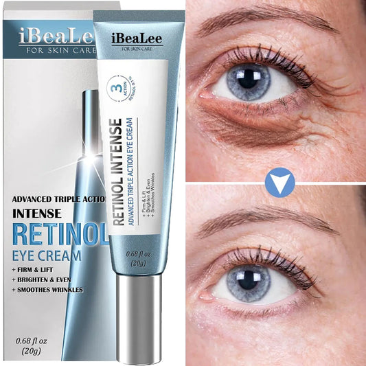 Creme para os olhos anti-rugas, retinol, remoção de olheiras, linhas finas, bolsa para os olhos, anti-inchaço, anti-envelhecimento, clareamento da pele